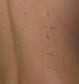 Visible Exfoliation Set